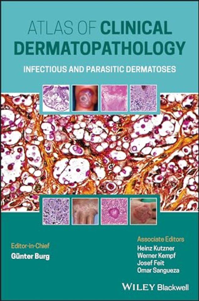 Atlas of Clinical Dermatopathology – Infectious and Parasitic Dermatoses