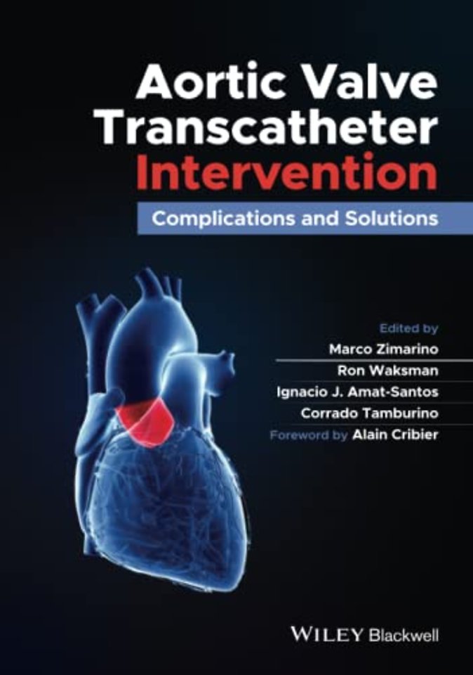 Aortic Valve Transcatheter Intervention