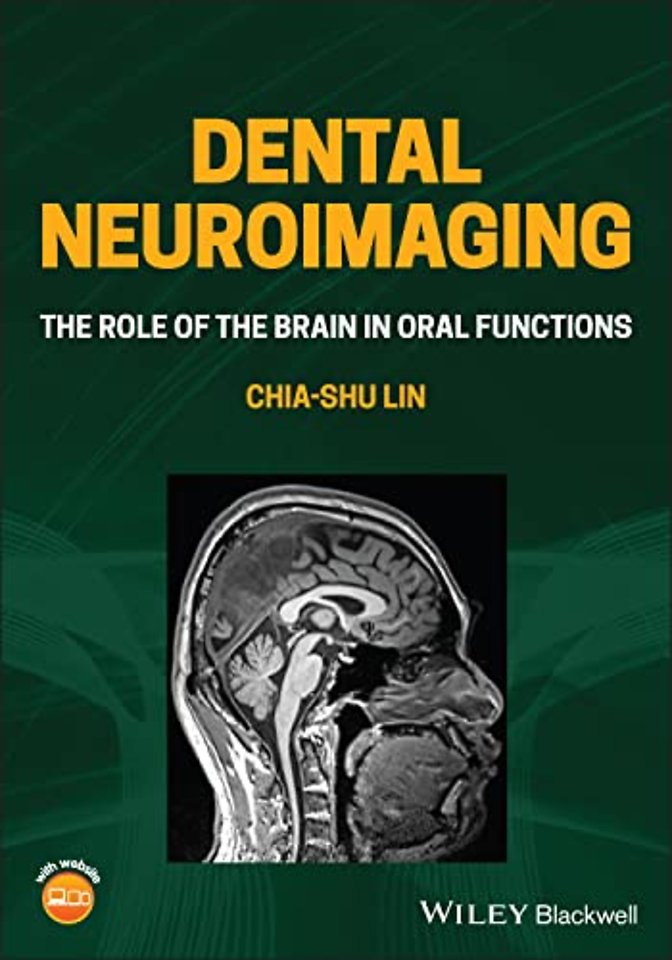 Dental Neuroimaging – The Role of the Brain in Oral Functions