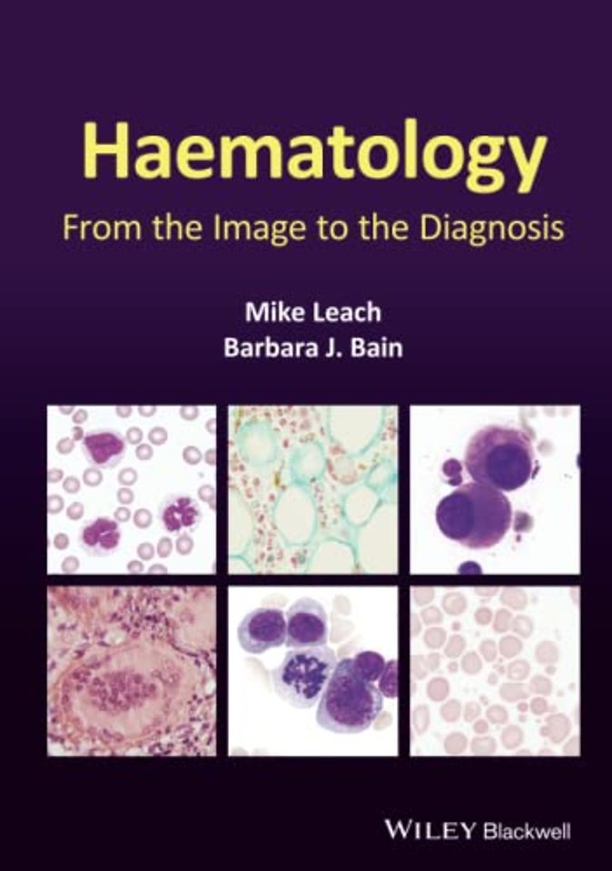 Haematology