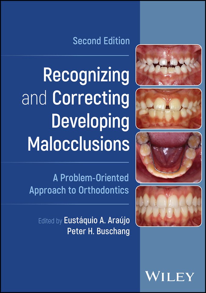 Recognizing and Correcting Developing Malocclusion s: A Problem–Oriented Approach to Orthodontics, Se cond Edition