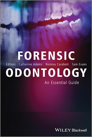 Forensic Odontology – An Essential Guide