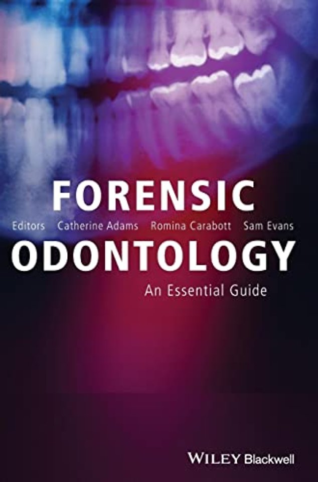 Forensic Odontology – An Essential Guide