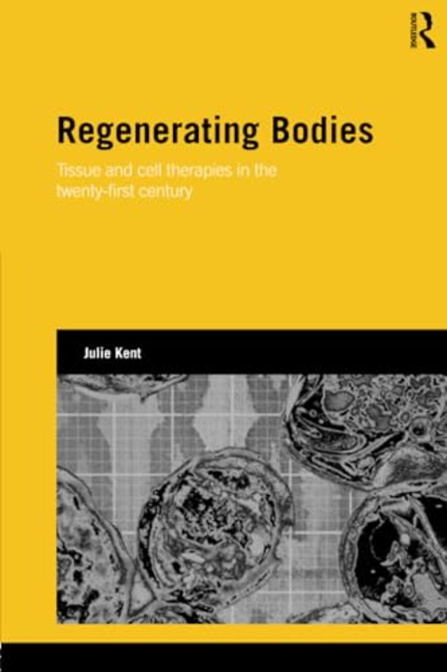 Regenerating Bodies