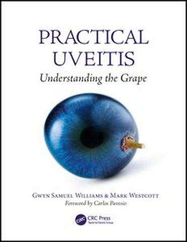 Practical Uveitis