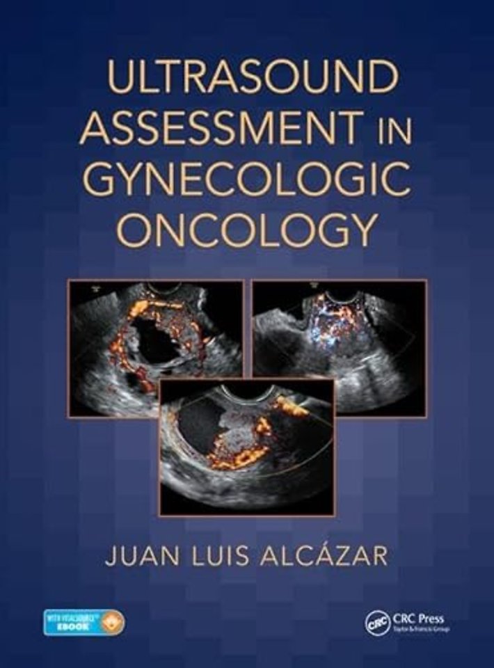 Ultrasound Assessment in Gynecologic Oncology