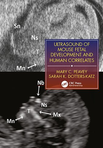 Ultrasound of Mouse Fetal Development and Human Correlates
