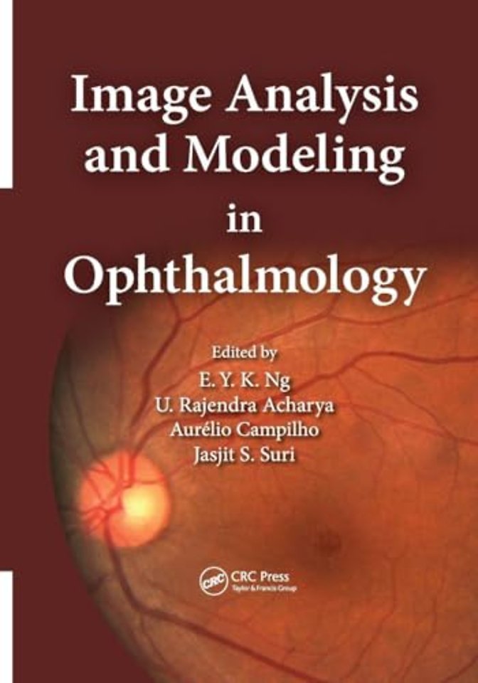 Image Analysis and Modeling in Ophthalmology