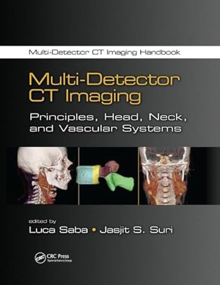 Multi-Detector CT Imaging