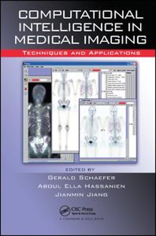 Computational Intelligence in Medical Imaging
