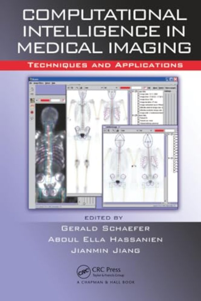 Computational Intelligence in Medical Imaging