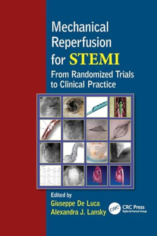 Mechanical Reperfusion for STEMI