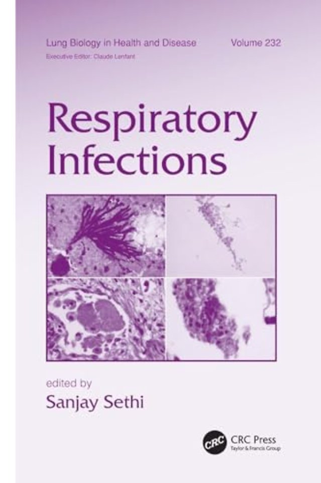 Respiratory Infections