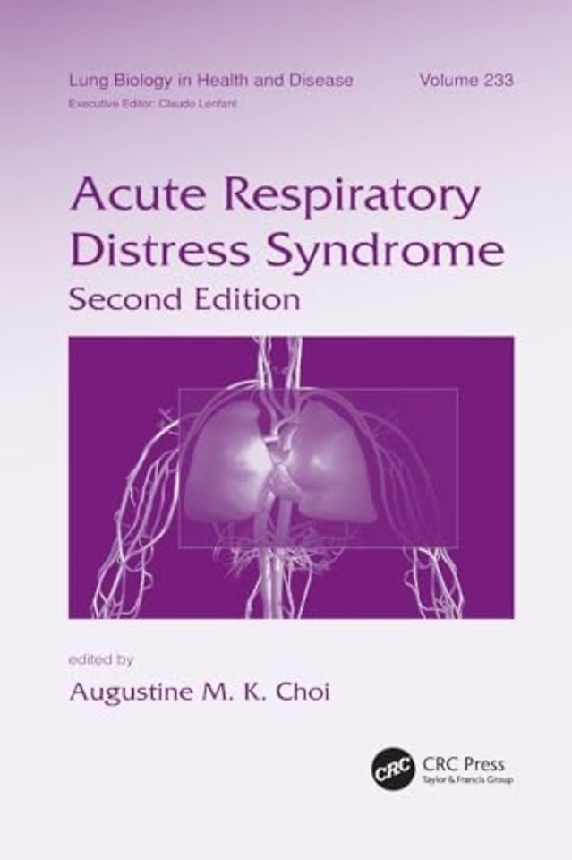 Acute Respiratory Distress Syndrome