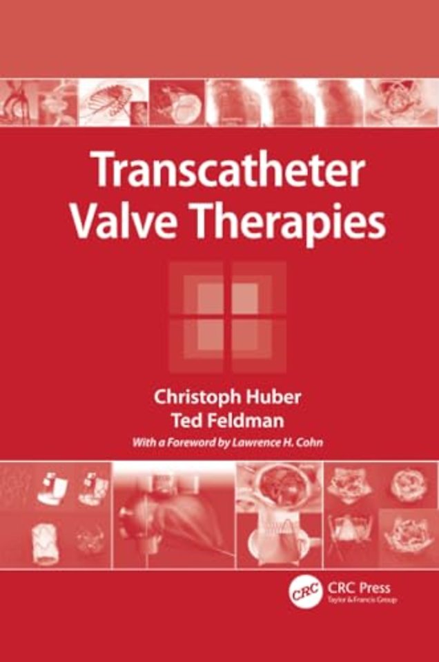 Transcatheter Valve Therapies