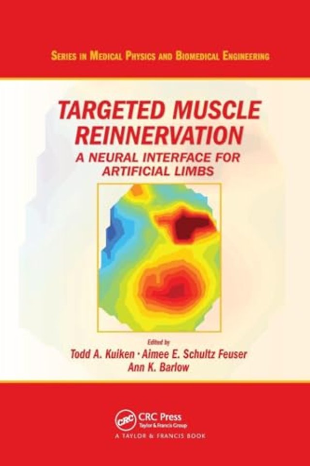 Targeted Muscle Reinnervation