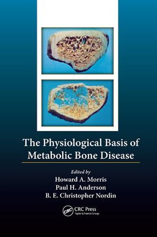 Physiological Basis of Metabolic Bone Disease