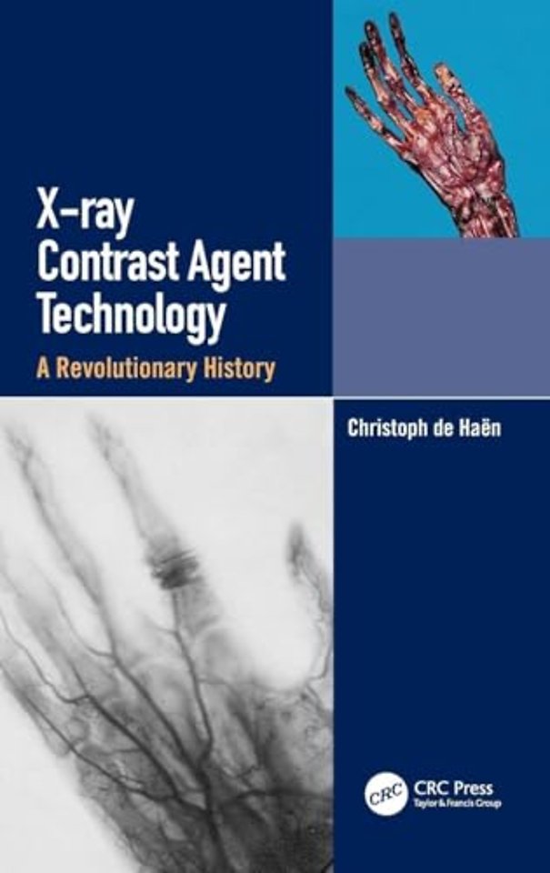 X-ray Contrast Agent Technology