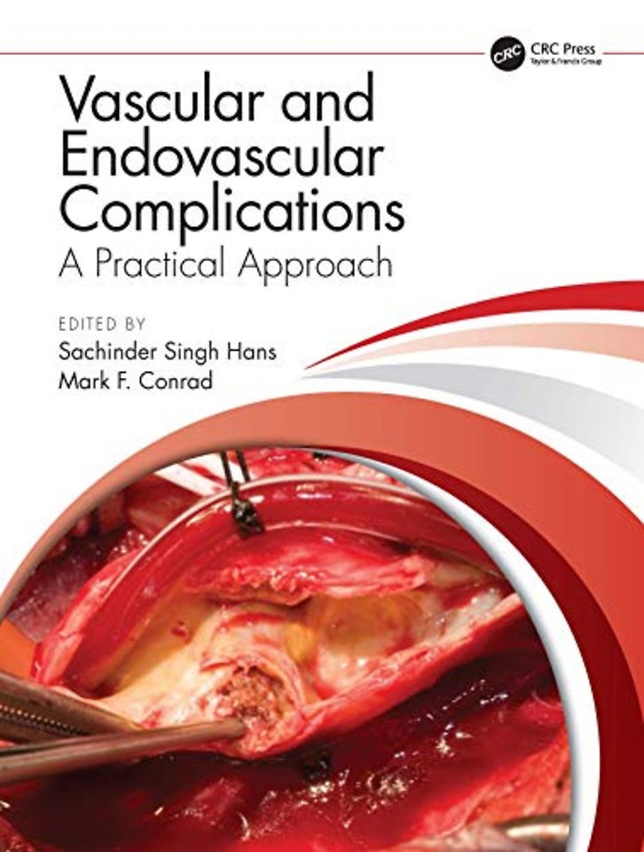 Vascular and Endovascular Complications: A Practical Approach