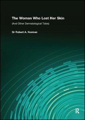Woman Who Lost Her Skin