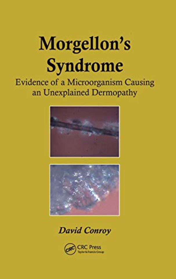 Morgellon's Syndrome