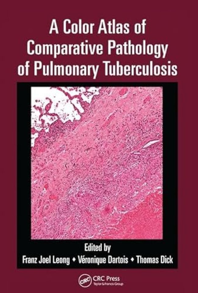 Color Atlas of Comparative Pathology of Pulmonary Tuberculosis