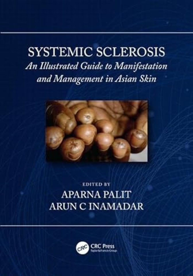 Systemic Sclerosis