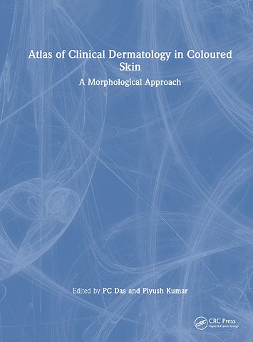 Atlas of Clinical Dermatology in Coloured Skin