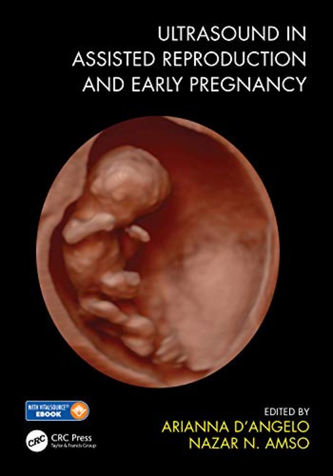 Ultrasound in Assisted Reproduction and Early Pregnancy