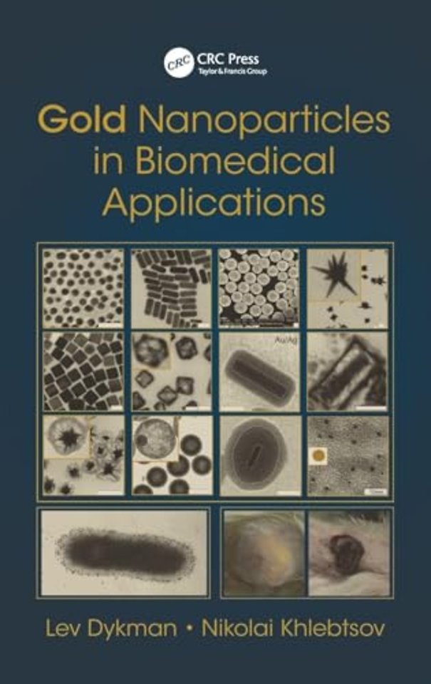 Gold Nanoparticles in Biomedical Applications