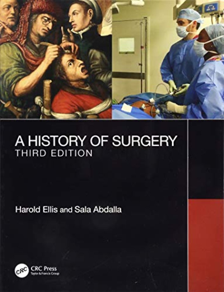 History of Surgery
