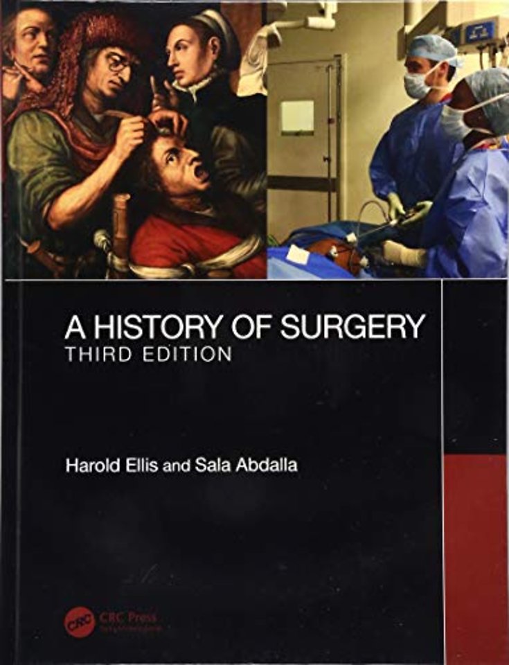 History of Surgery