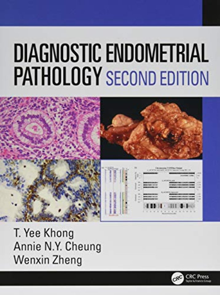 Diagnostic Endometrial Pathology 2E