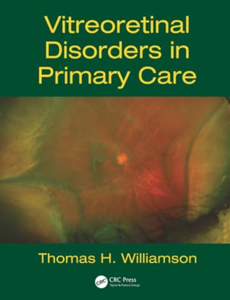 Vitreoretinal Disorders in Primary Care