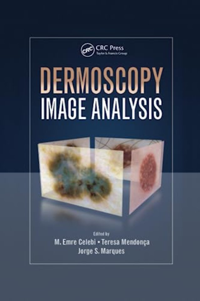 Dermoscopy Image Analysis
