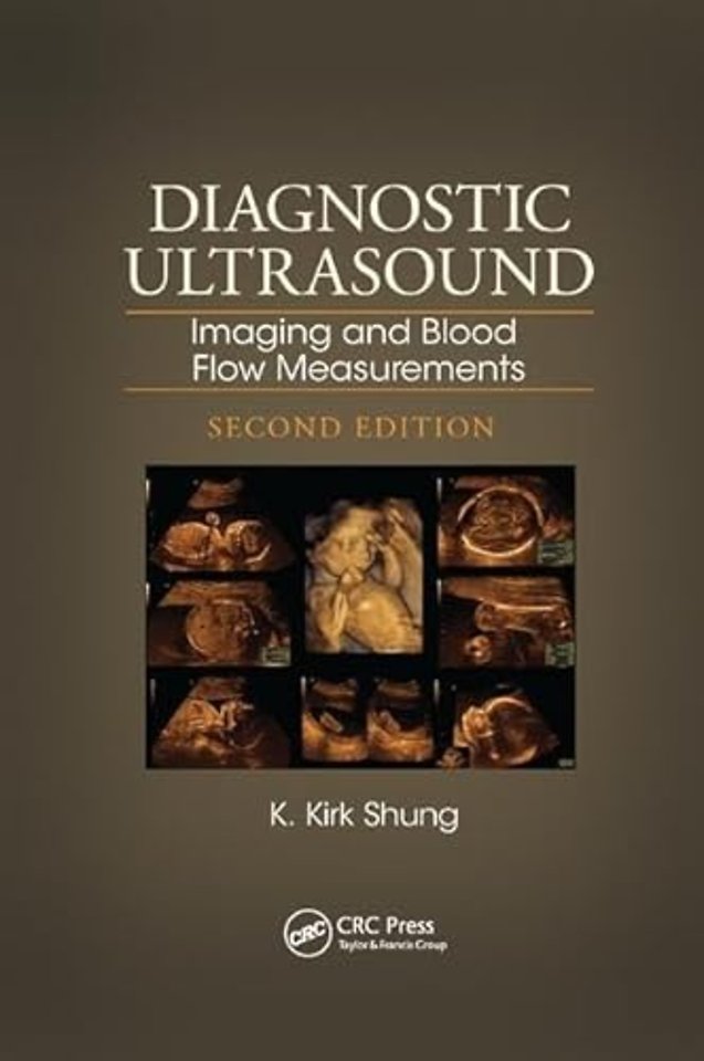 Diagnostic Ultrasound
