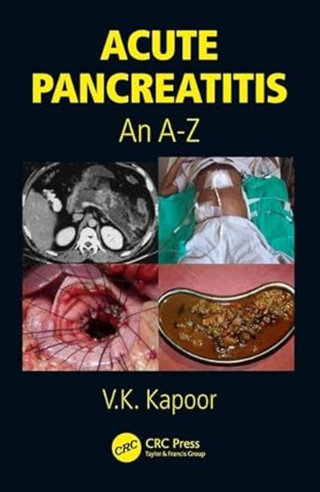 Acute Pancreatitis