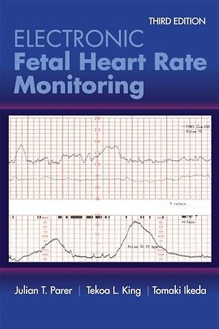 Electronic Fetal Heart Rate Monitoring: The 5–Ti – The 5–Tier System