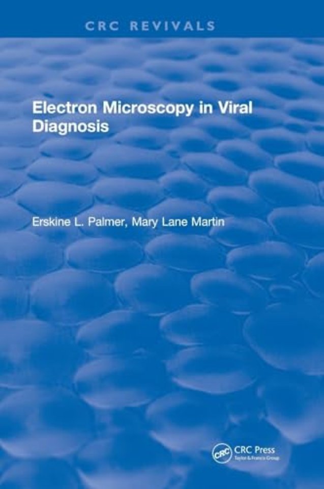 Electron Microscopy in Viral Diagnosis