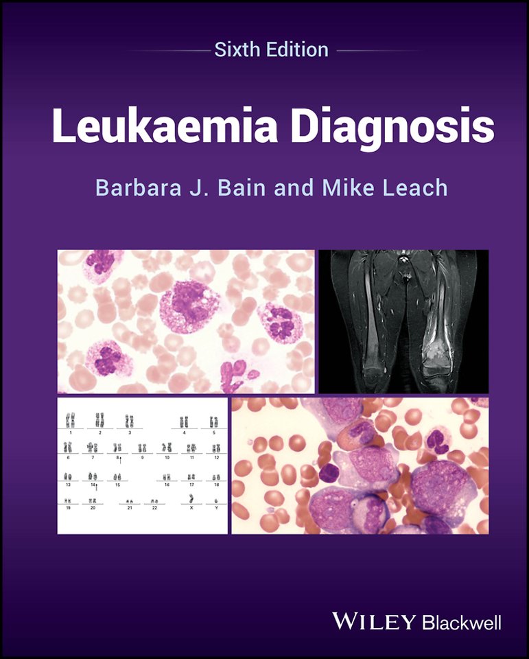 Leukaemia Diagnosis, Sixth Edition