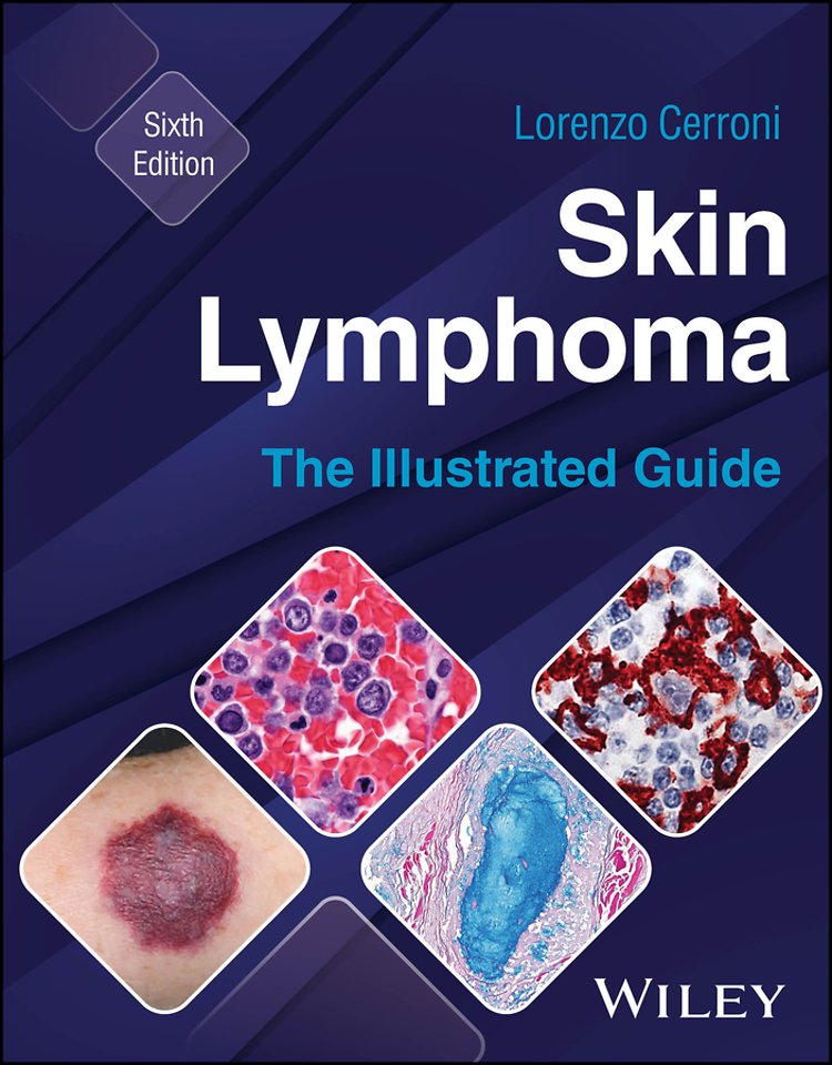 Skin Lymphoma – The Illustrated Guide