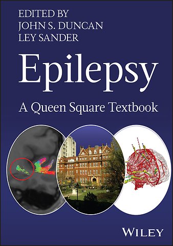 Epilepsy