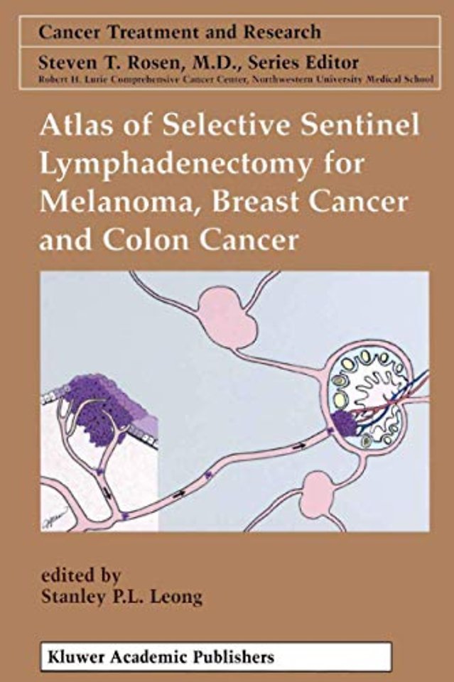 Atlas of Selective Sentinel Lymphadenectomy for Melanoma, Breast Cancer and Colon Cancer