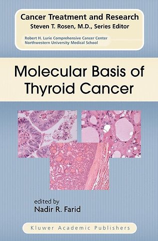 Molecular Basis of Thyroid Cancer