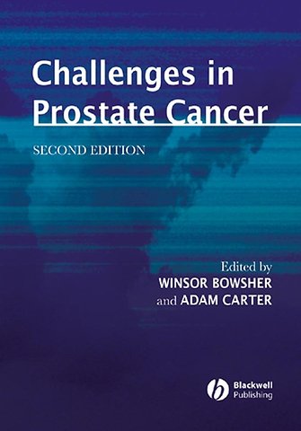 Challenges in Prostate Cancer 2e