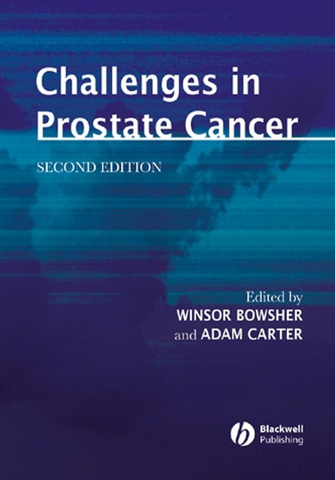 Challenges in Prostate Cancer 2e