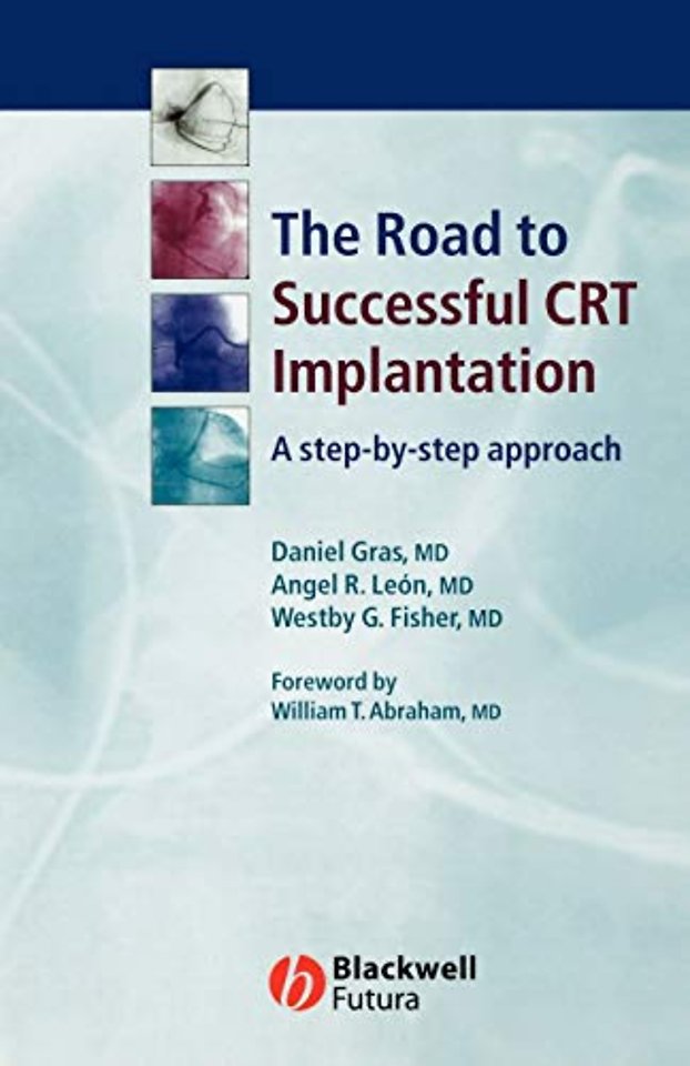 The Road to Successful CRT Implantation: A step– by–step approach