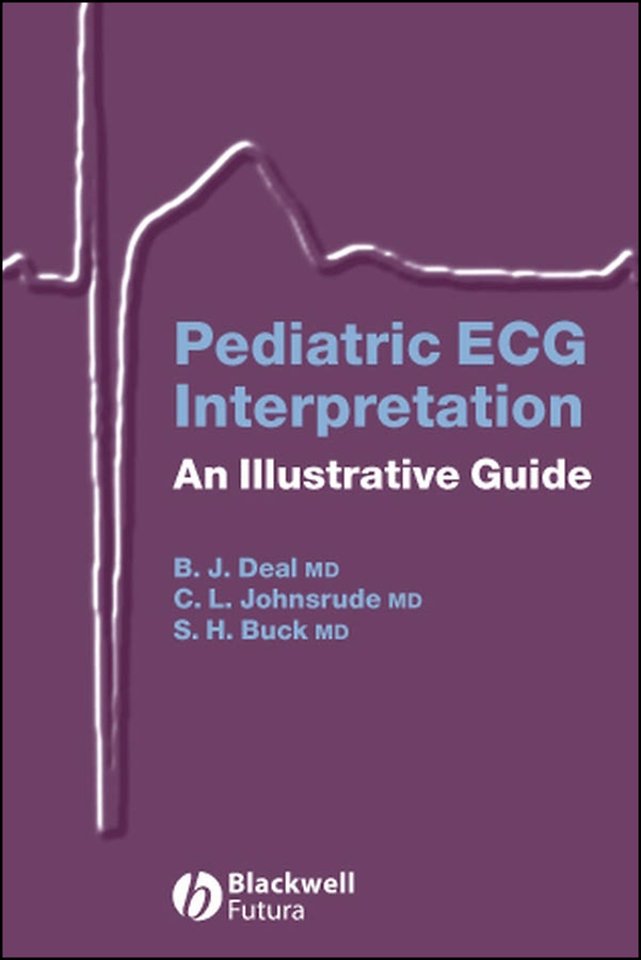 Pediatric ECG Interpretation – An Illustrative Guide