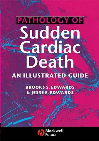 Pathology of Sudden Cardiac Death – An Illustrated Guide