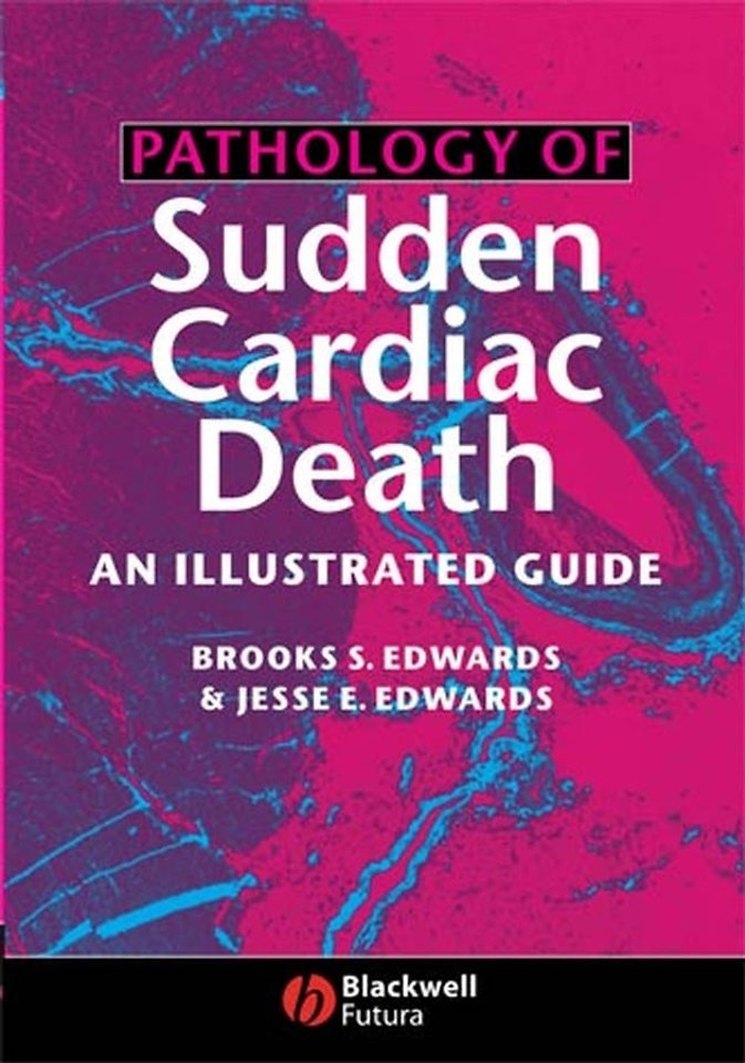 Pathology of Sudden Cardiac Death – An Illustrated Guide